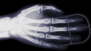 mano a través de rayos X